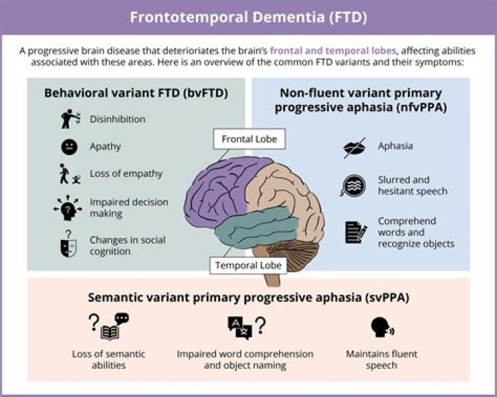 Prevalence and pathology of vascular dementia in the oldest old - ePrints