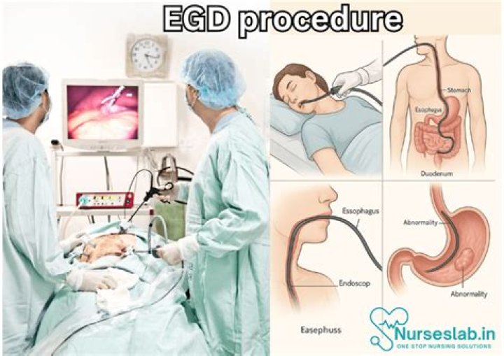 The Purpose And Procedure of an EGD Test